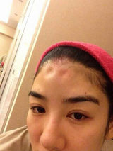 组图：疑似黄奕医院做家暴伪证过程曝光