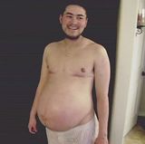 幻灯图集：怀孕男汤马斯-比提生下第二胎